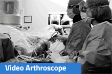 Video of Arthoscopy